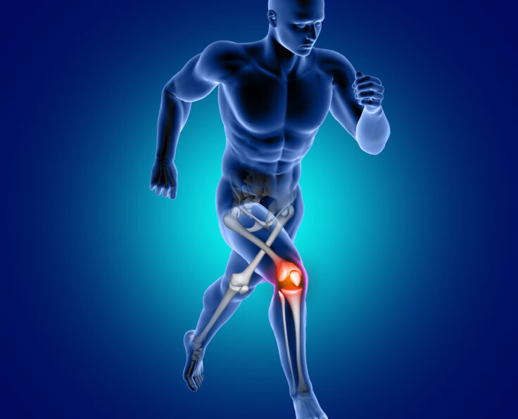 3D render of a male medical figure running with knee bone highlighted